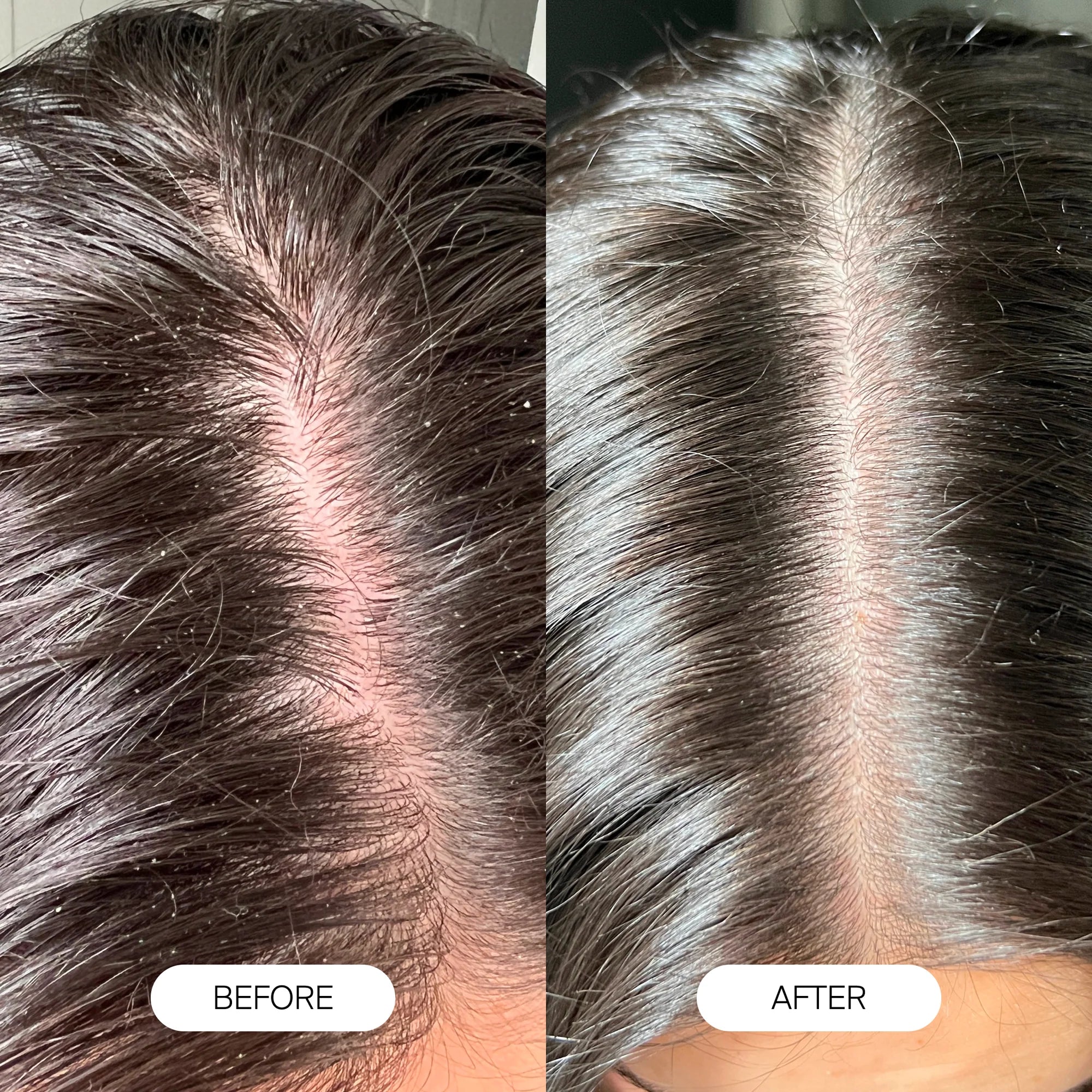 Restore Your Glowing Skin & Shiny Hair in The First Week with Pure Splash™