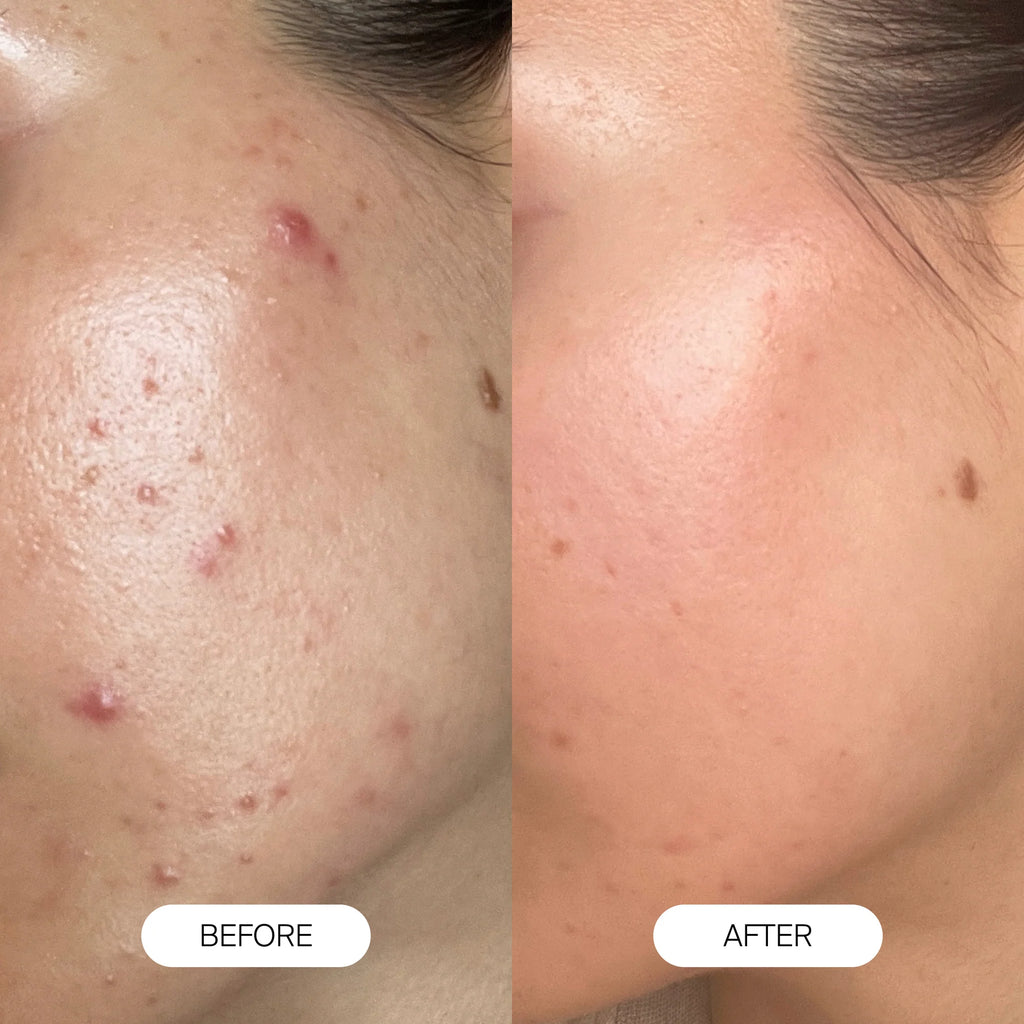 Restore Your Glowing Skin & Shiny Hair in The First Week with Pure Splash™